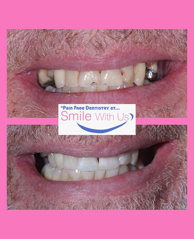 Before - smilewithus